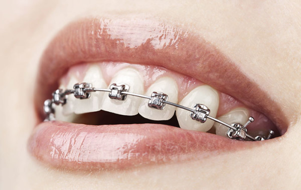 Orthodontics in Williams Landing